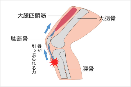 骨・関節の障害